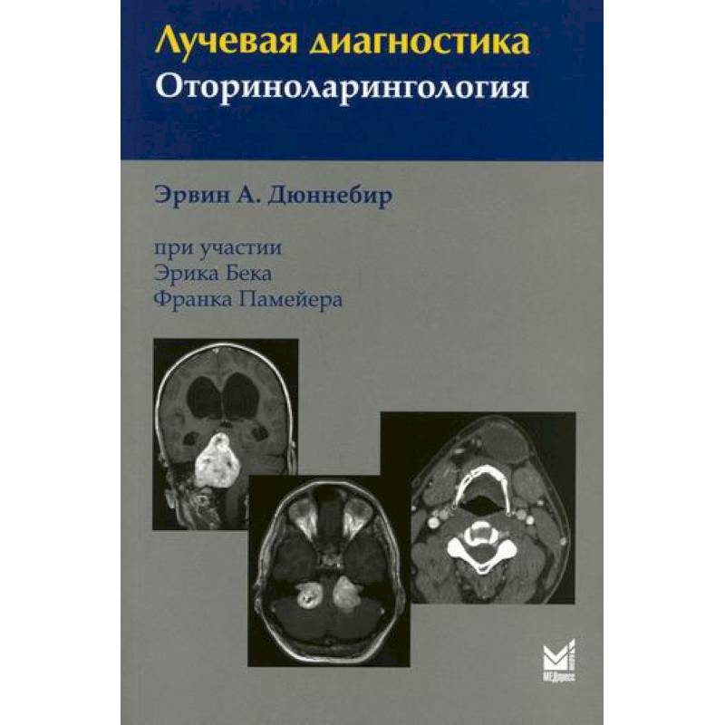 Лучевая диагностика в оториноларингологии и офтальмологии презентация