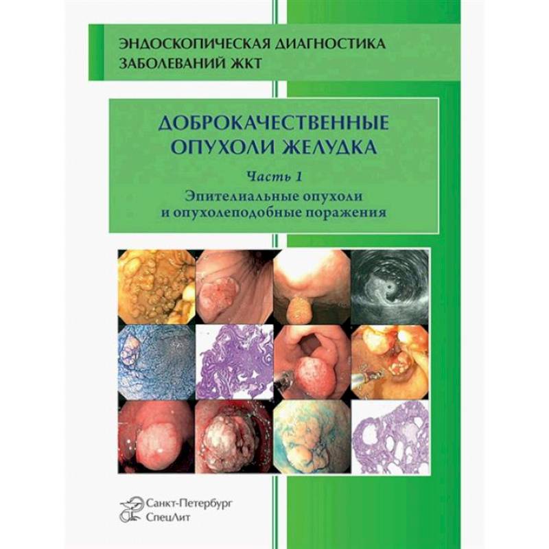 Доброкачественные опухоли желудка. Часть1: Эпителиальные опухоли и опухолеподобные поражения: Учебно-методическое пособие