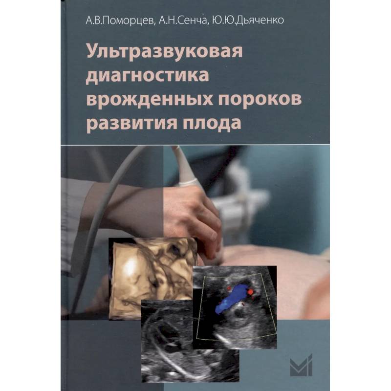 Ультразвуковая диагностика врожденных пороков развития плода