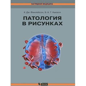 Патология в рисунках