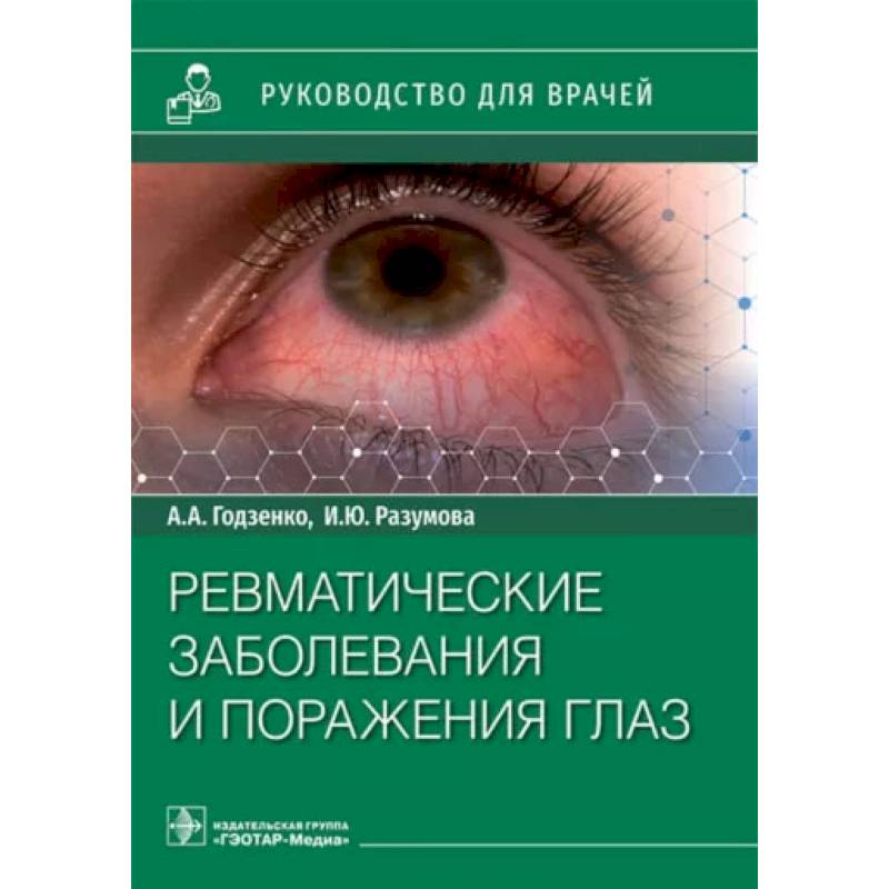 Ревматические заболевания и поражения глаз