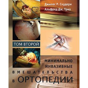 Минимально инвазивные вмешательства в ортопедии. В 2 томах. Том 2