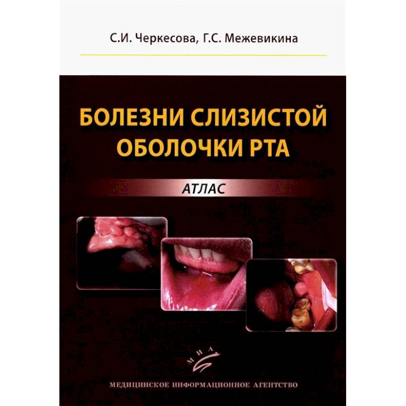 Болезни слизистой оболочки рта: атлас Болезни слизистой оболочки рта: атлас