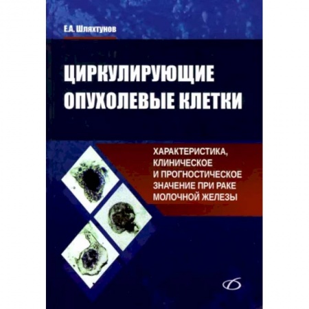 Специальная медицина, книга Циркулирующие опухолевые клетки