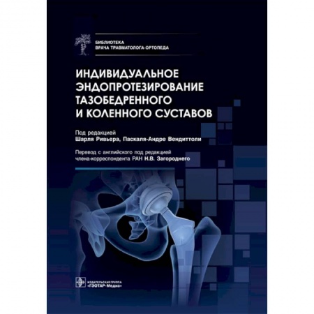 Книги, книга Индивидуальное эндопротезирование тазобедренного и коленного суставов