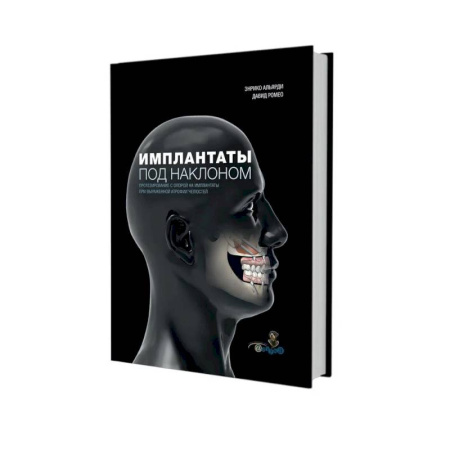 Специальная медицина, книга Имплантаты под наклоном. Протезирование с опорой на имплантаты при выраженной атрофии челюстей