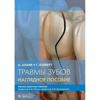 Травмы зубов. Наглядное пособие
