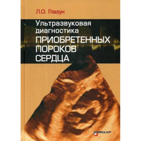 Диагностика. Методы и виды, книга Ультразвуковая диагностика приобретенных пороков сердца