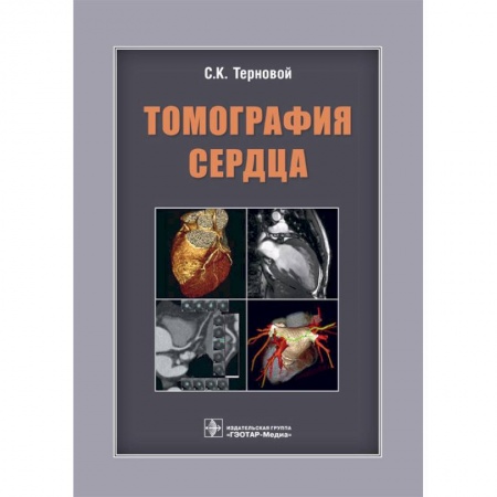 Специальная медицина, книга Томография сердца. Руководство для врачей