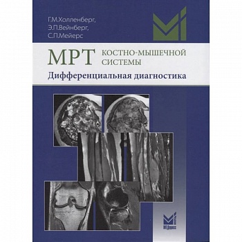 МРТ костно-мышечной системы. Дифференциальная диагностика