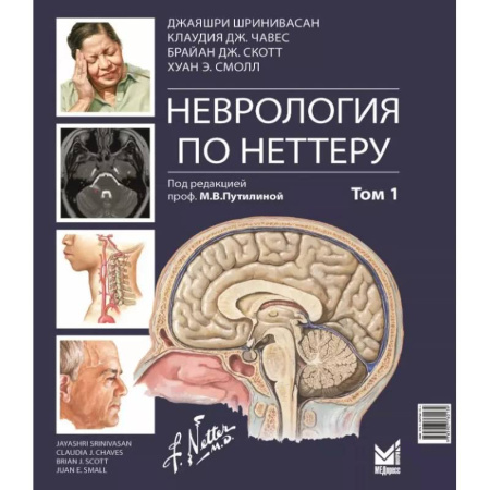 Медицинские энциклопедии и справочники, книга Неврология по Неттеру. В 3 т. Т. 1