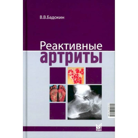 Медицинские энциклопедии и справочники, книга Реактивные артриты. Урогенитальные и постэнтероколитические