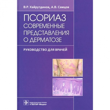 Специальная медицина, книга Псориаз. Современные представления о дерматозе. Руководство для врачей