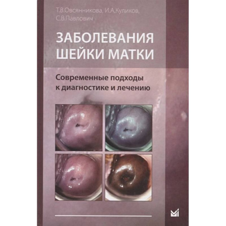 Специальная медицина, книга Заболевания шейки матки. Современные подходы к диагностике и лечению