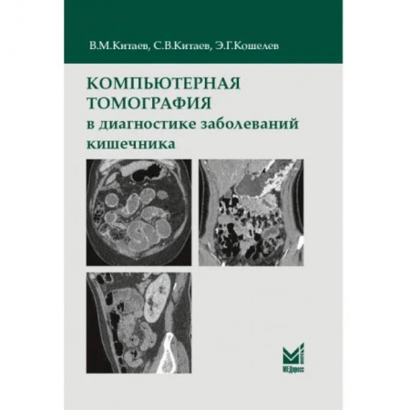 Диагностика. Методы и виды, книга Компьютерная томография в диагностике заболеваний кишечника