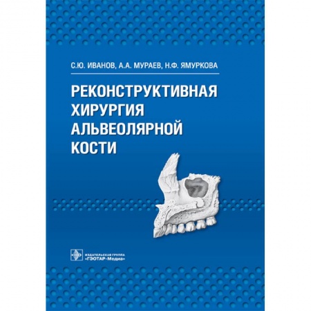 Книги, книга Реконструктивная хирургия альвеолярной кости