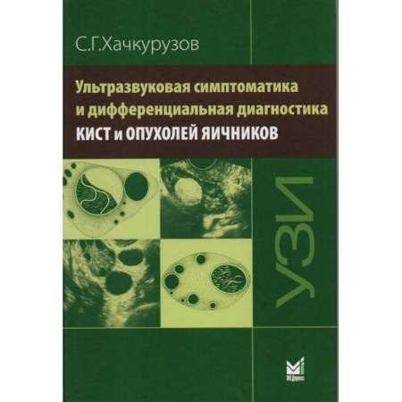 Студентам и аспирантам, книга Ультразвуковая симптоматика и дифференциальная диагностика кист и опухолей яичников