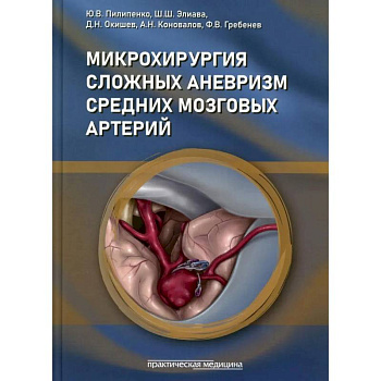 Микрохирургия сложных аневризм средних мозговых артерий: гигантских, фузиформных и частично тромбированных