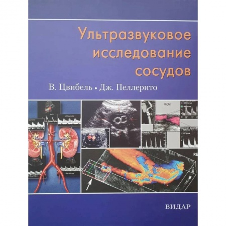Диагностика. Методы и виды, книга Ультразвуковое исследование сосудов