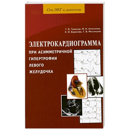 Книги, книга Электрокардиограмма при асимметричной гипертрофии левого желудочка